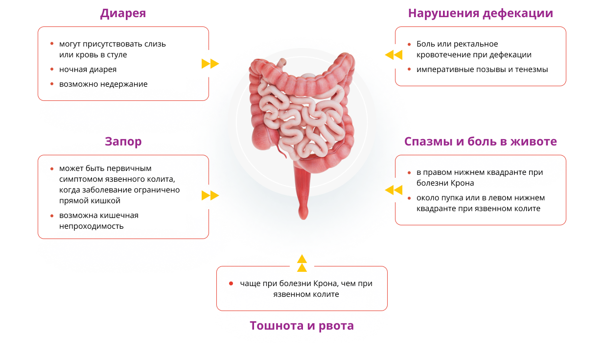 Кишечные проявления ВЗК
